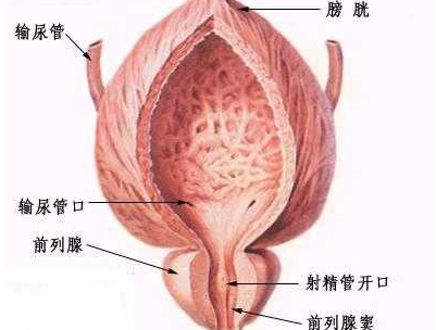 前列腺增生穿刺需要住院治疗吗